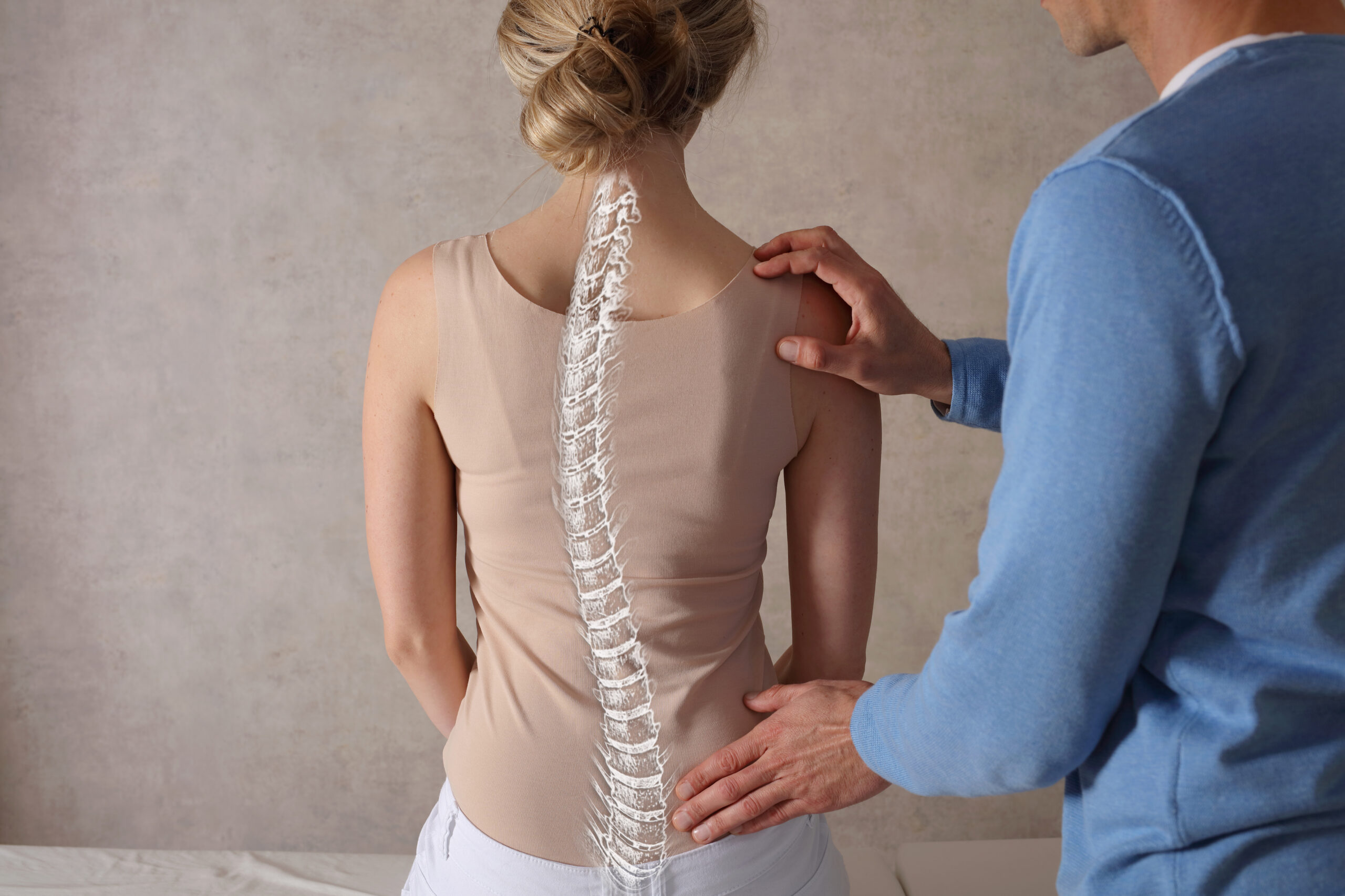 Person with scoliosis spinal curvature needing specialized treatment in Salinas