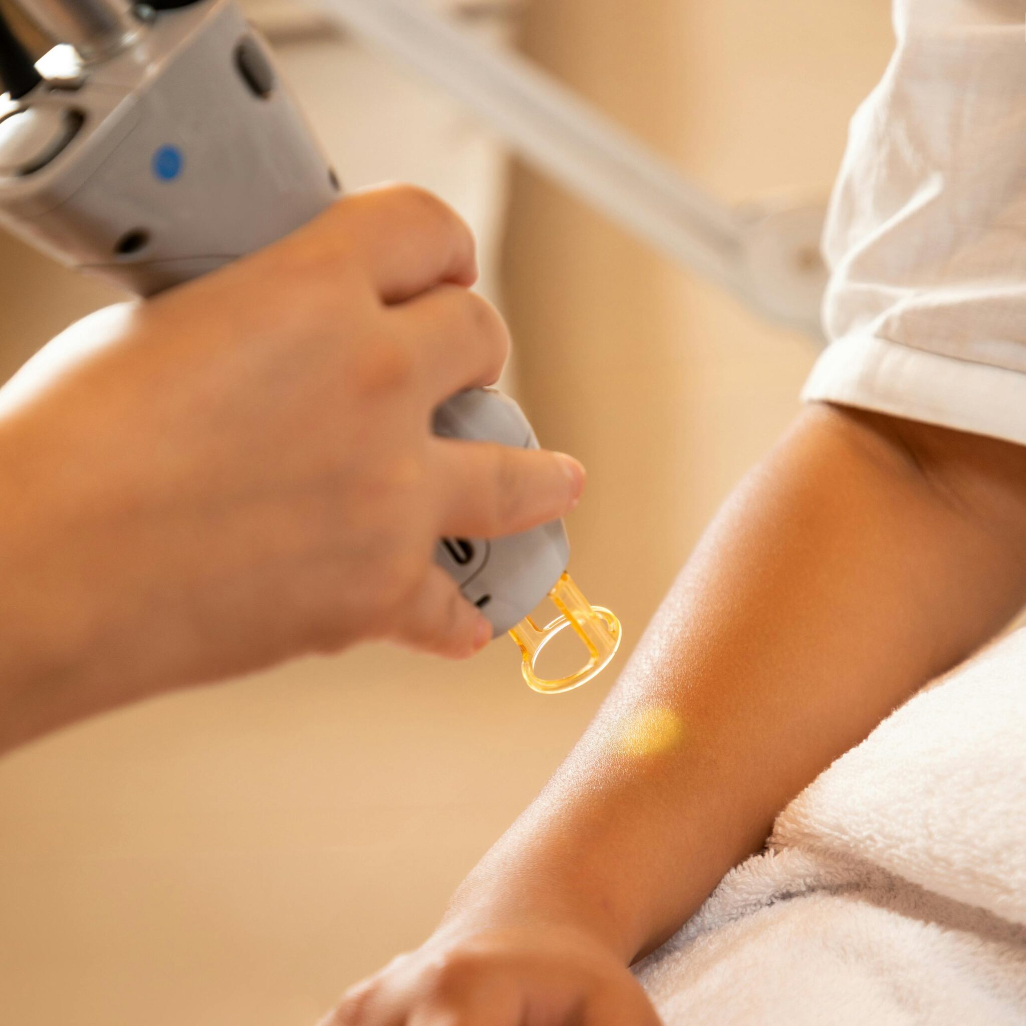Cold laser therapy treatment on patient's arm at Salinas chiropractic clinic for pain relief